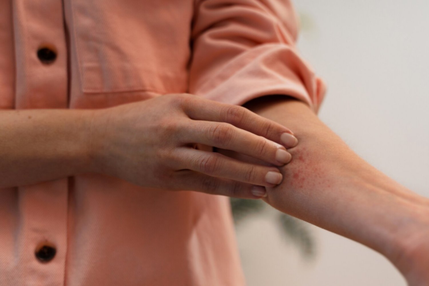 Lyme, la amenaza invisible que crece con el clima y desconcierta a la medicina