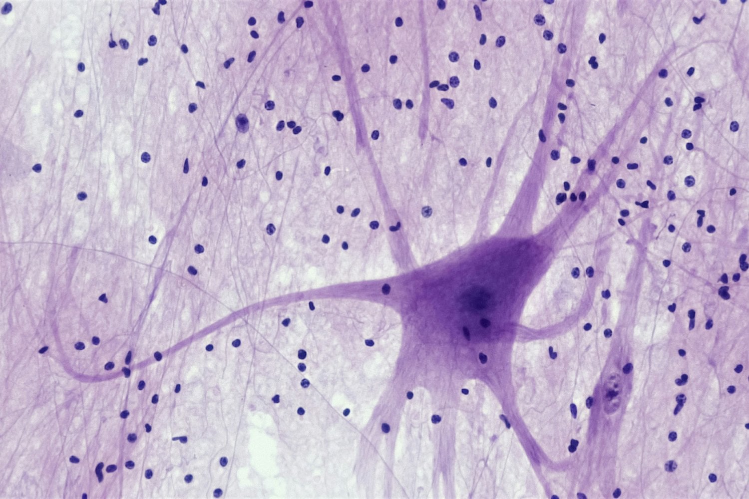 El Plan De China Para Desafiar A Neuralink
