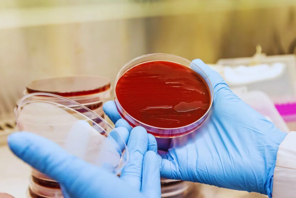 Un bot argentino se adelanta al diagnóstico. Una inteligencia artificial que interpreta bacterias y promete cambiar la salud pública