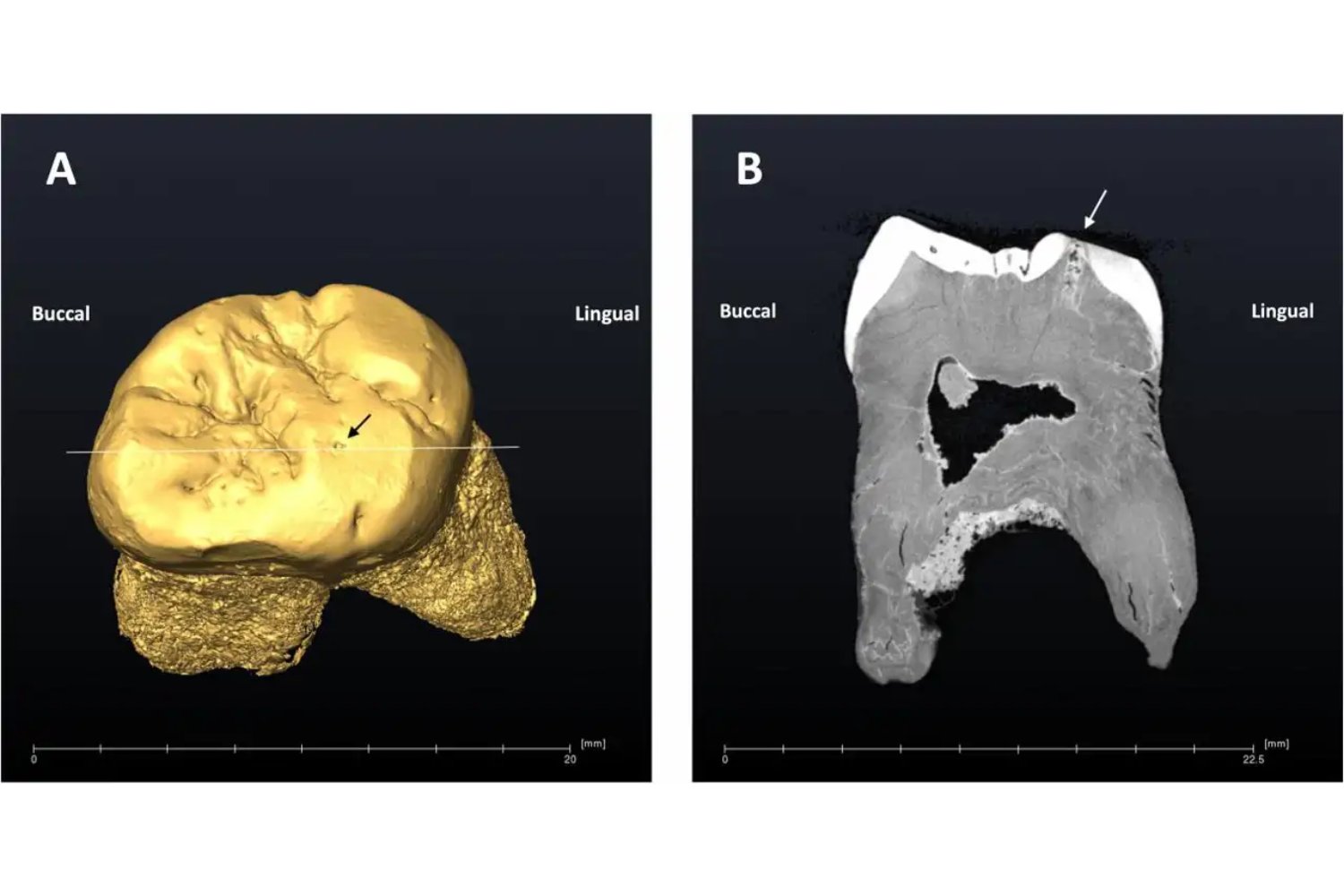 Un diente de hace 49.000 años revela un secreto insólito: cómo los neandertales usaban la boca como su “tercera mano”