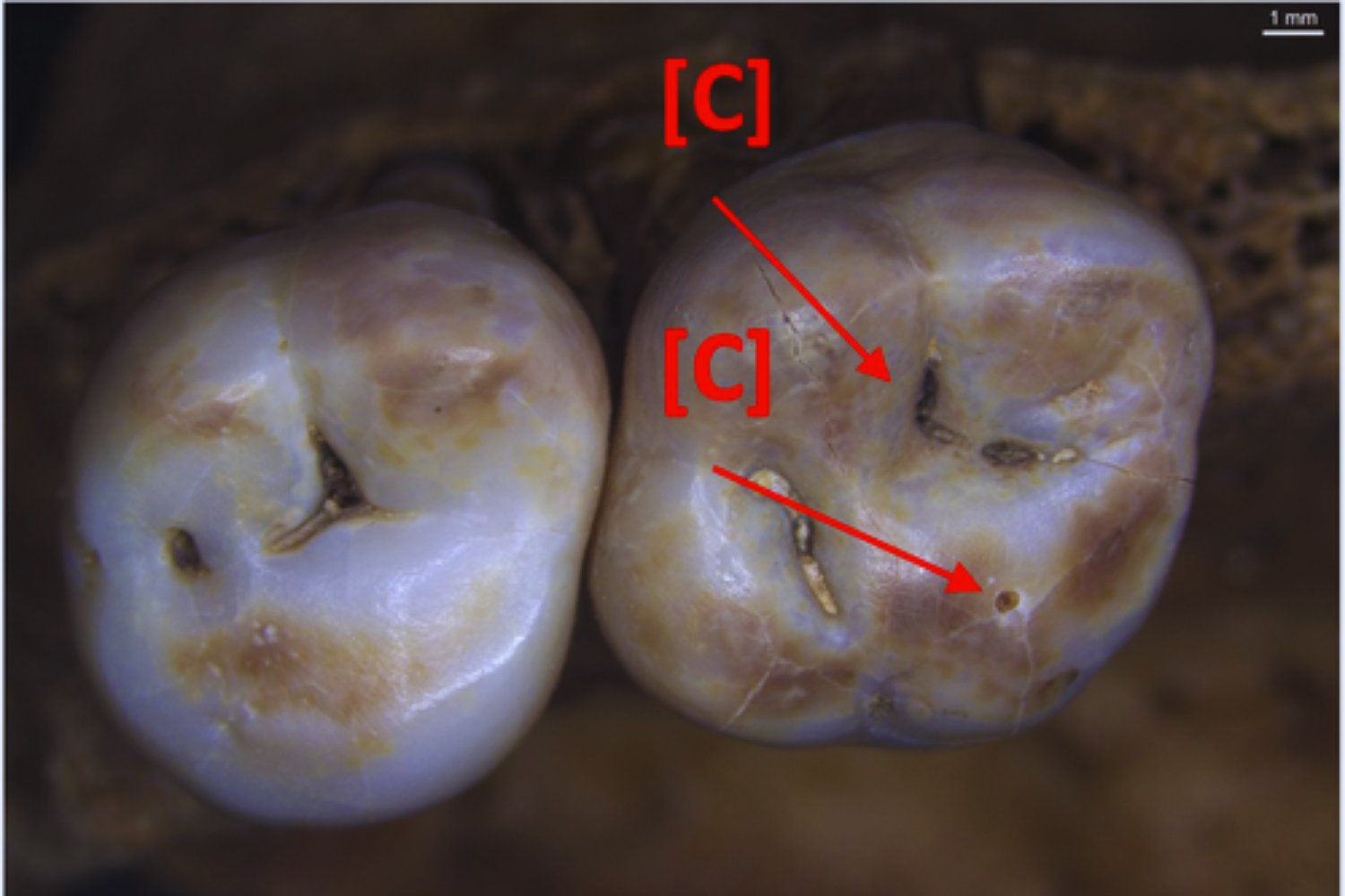 Un diente de hace 49.000 años revela un secreto insólito: cómo los neandertales usaban la boca como su “tercera mano”