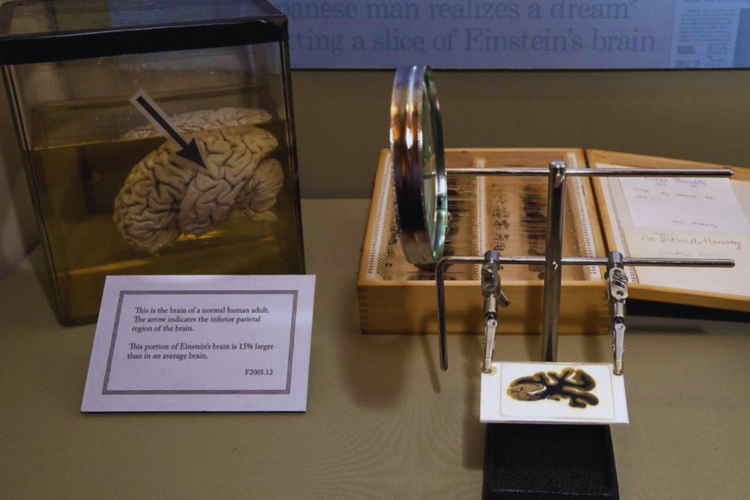 La técnica china que promete lo imposible: leer el cerebro conservado de Einstein tras 70 años de silencio