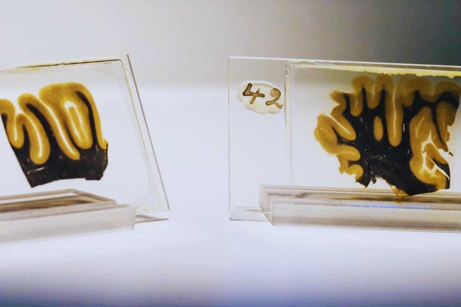 La técnica china que promete lo imposible: leer el cerebro conservado de Einstein tras 70 años de silencio