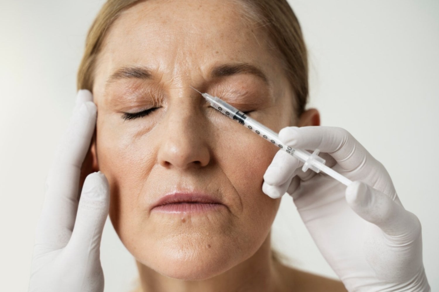 Ceguera por rellenos faciales: la complicación rara que exige máxima precaución