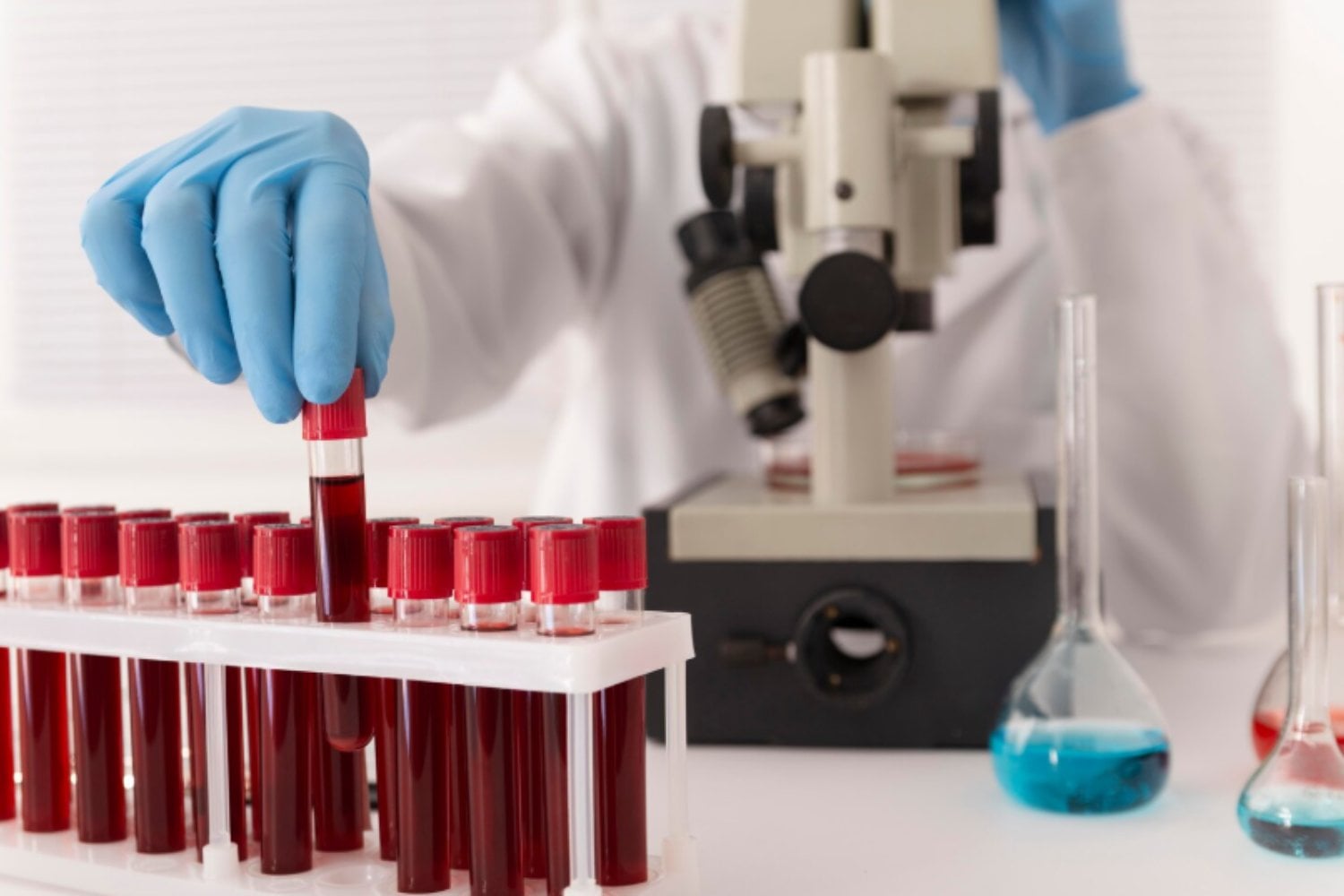 Un análisis de sangre capaz de detectar cáncer de cabeza y cuello hasta una década antes