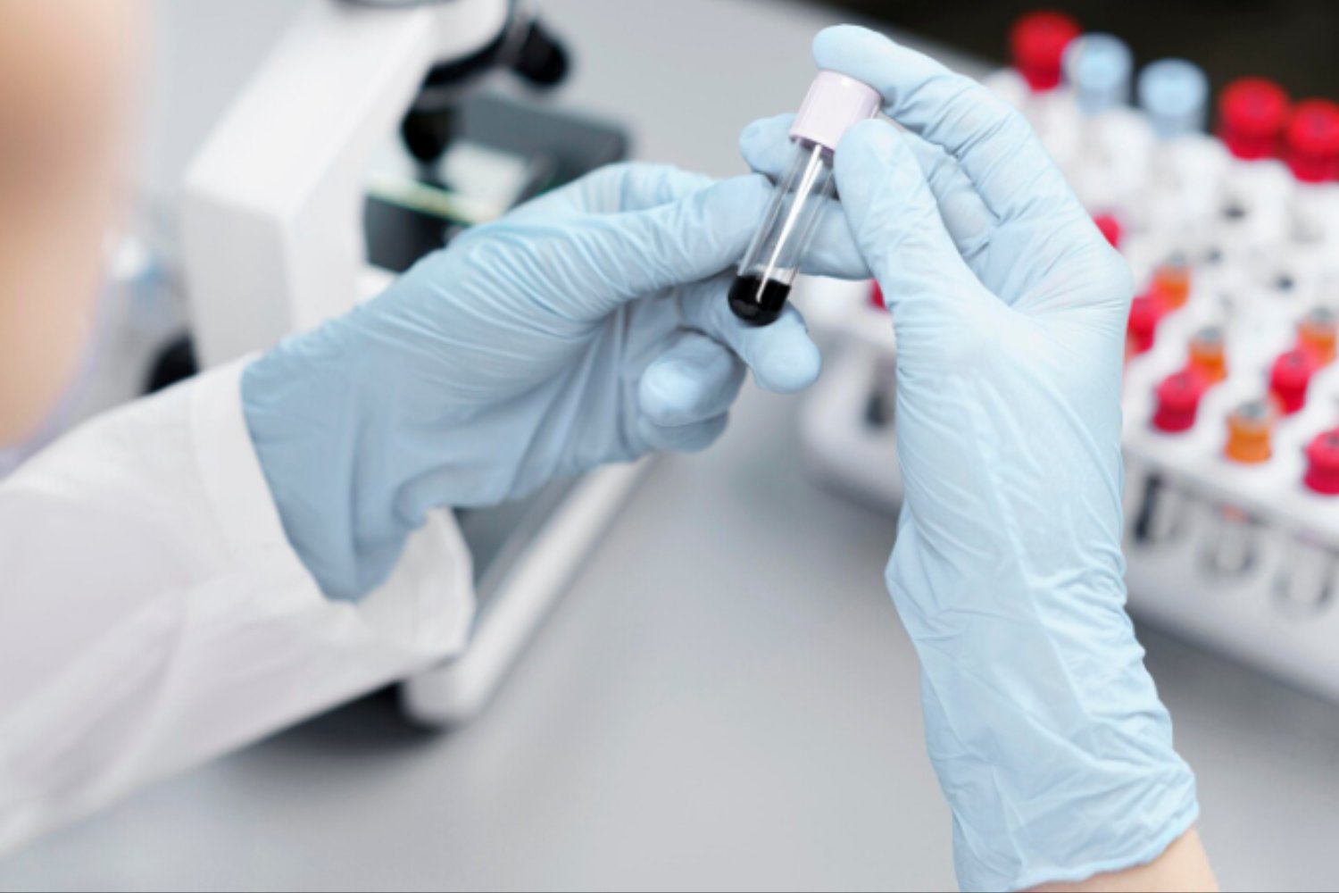 Un análisis de sangre capaz de detectar cáncer de cabeza y cuello hasta una década antes