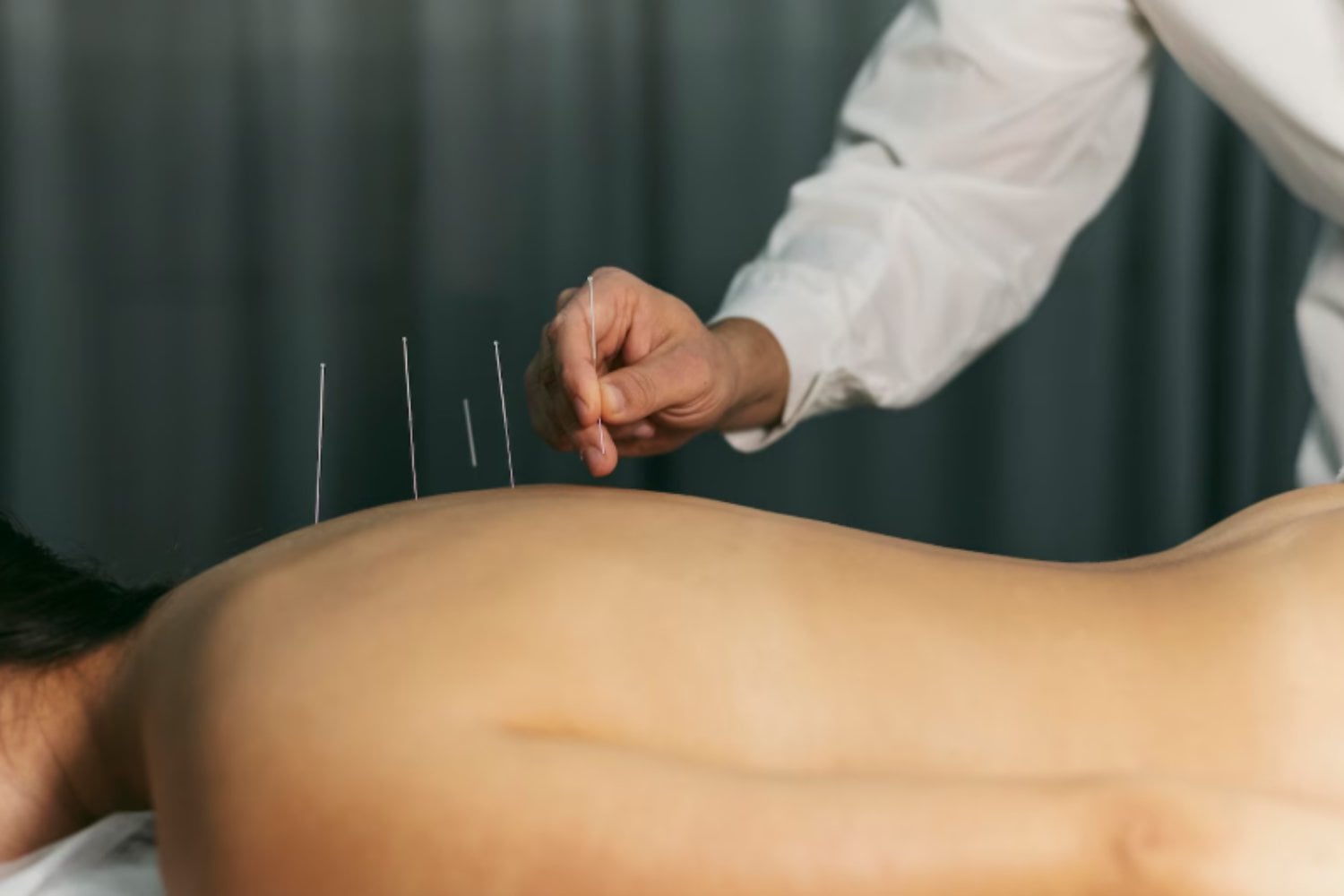 Acupuntura y dolor lumbar crónico: la terapia ancestral que gana espacio en la medicina moderna