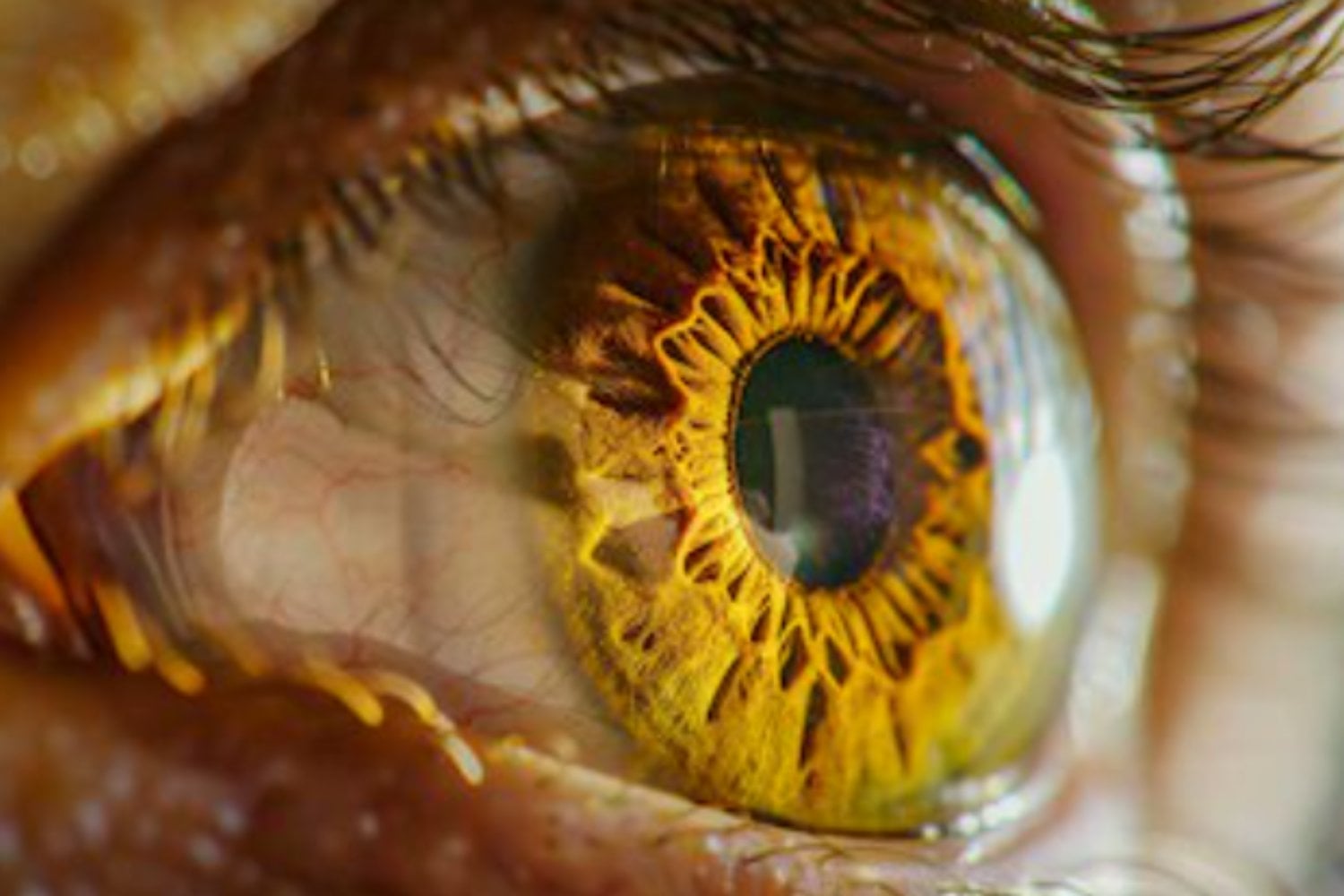 El “Óscar de la retina”: un logro argentino que revoluciona la cirugía ocular