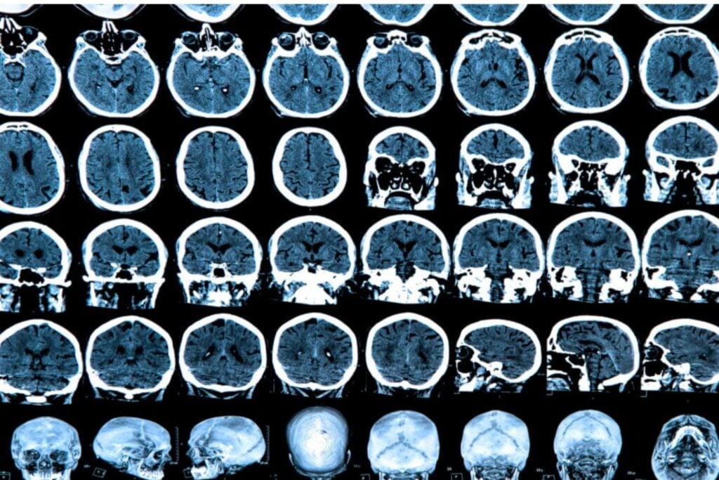 Donde Esta La Conciencia En El Cerebro
