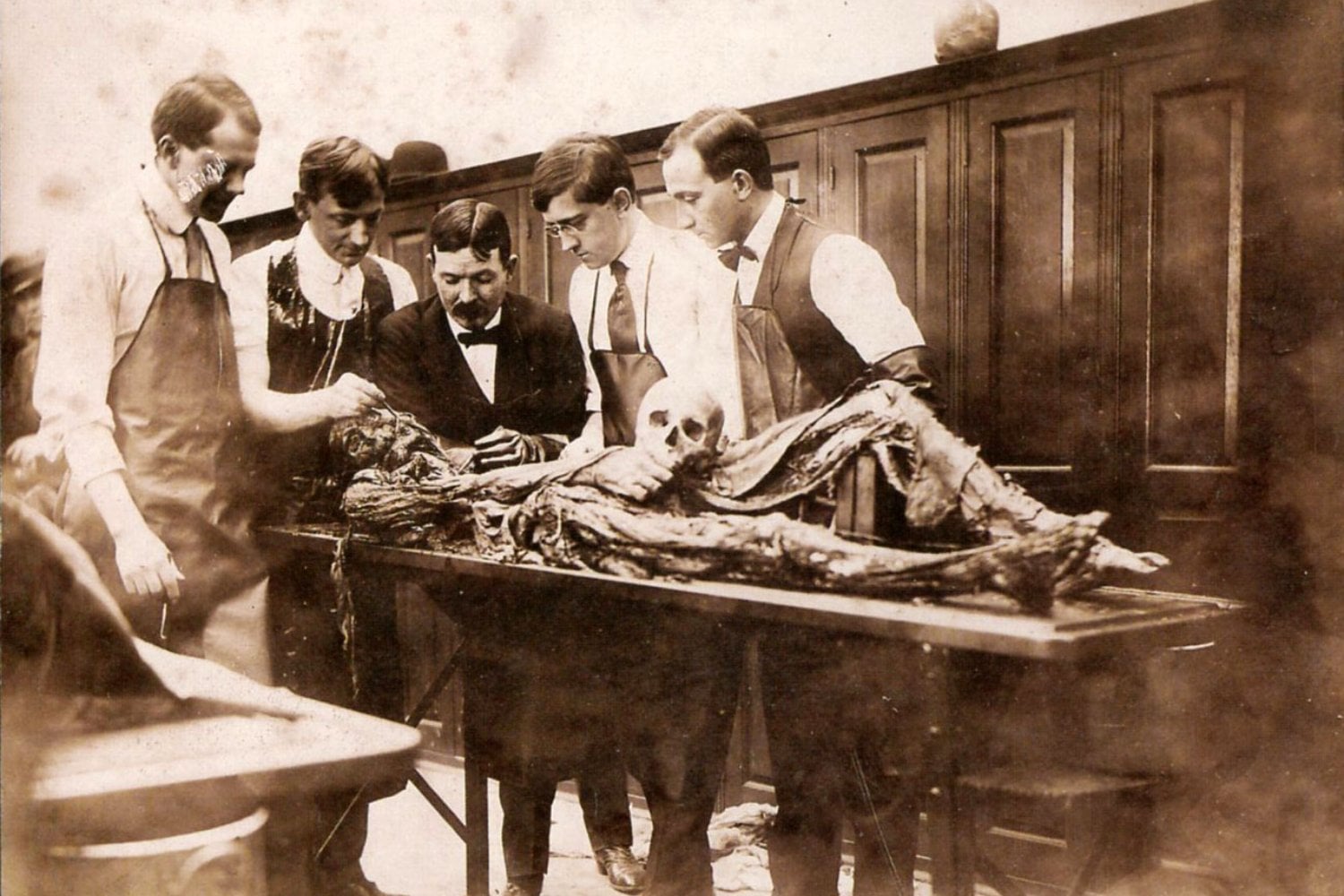 Cuando Europa se comió a sí misma: la medicina caníbal que convirtió cadáveres en remedios “curativos”