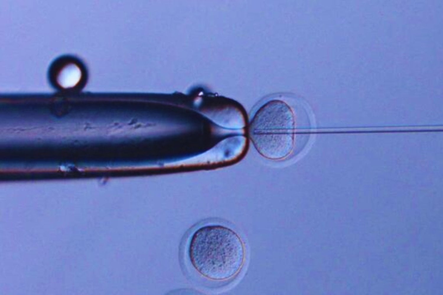 Ser padre a cualquier edad parece un triunfo de la biología. Hasta que la biología misma empieza a rebelarse