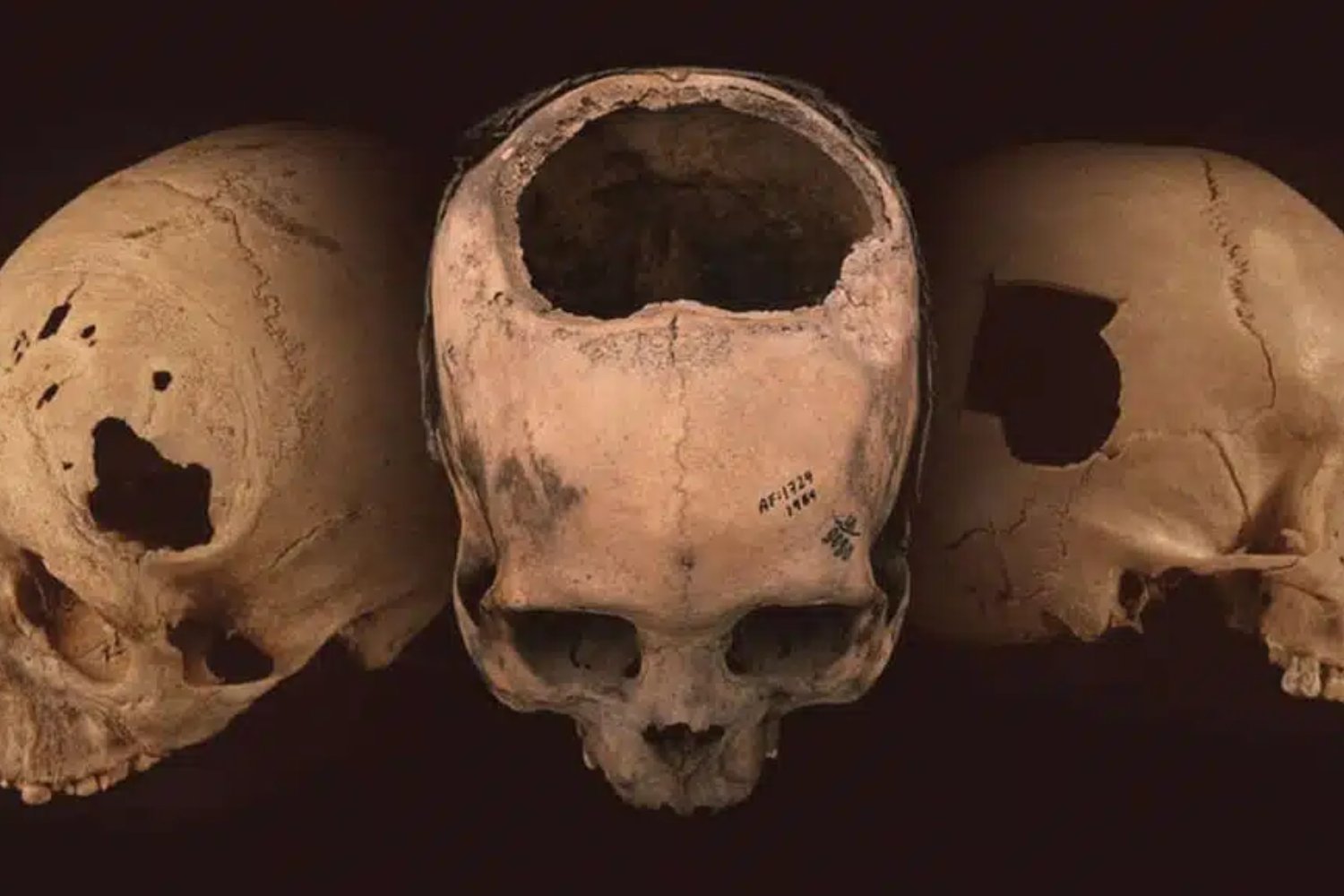El gran salto no fue caminar erguidos: el cerebro humano evolucionó el doble de rápido que el de otros simios
