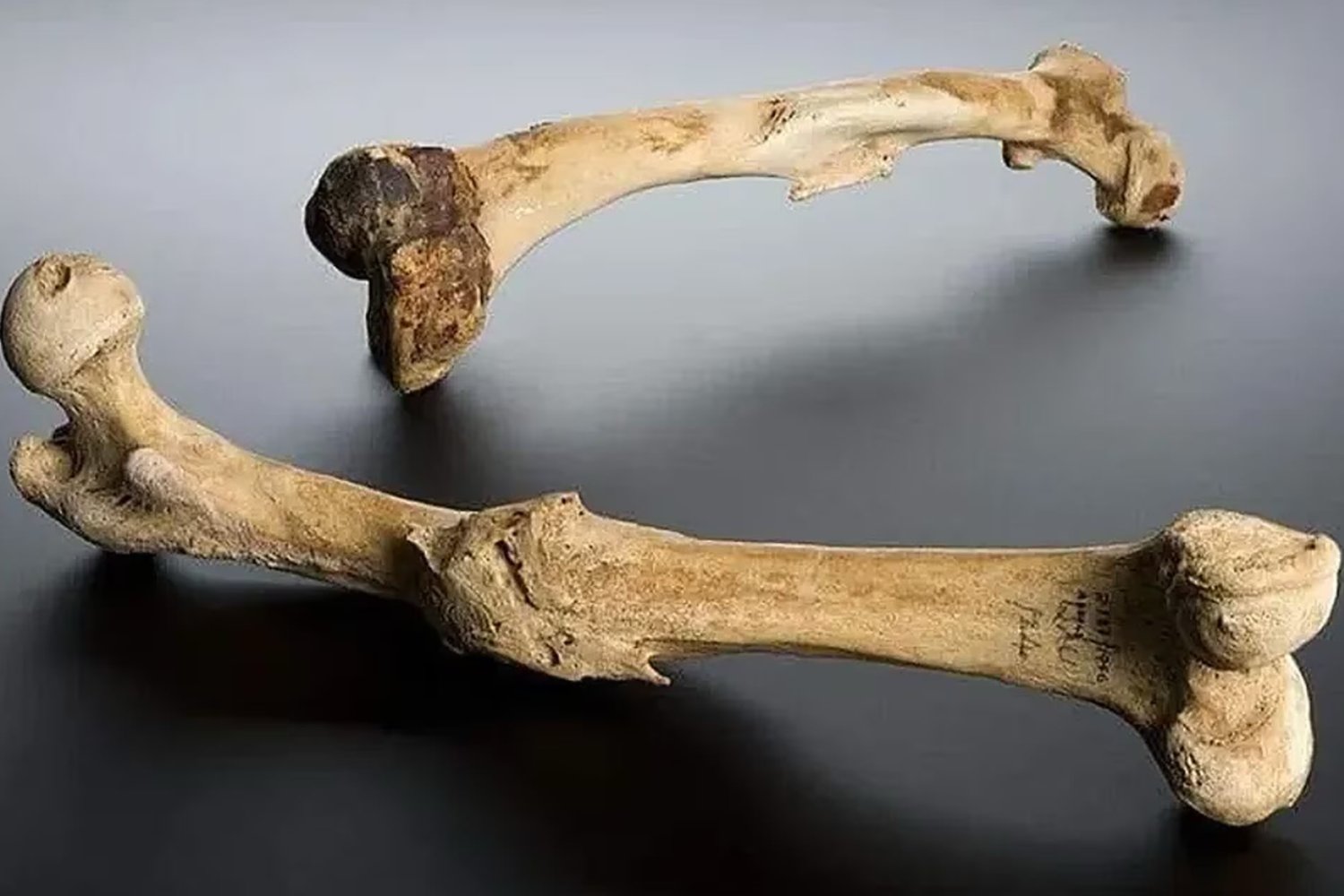 El niño del pasado que enfermó sin explicación: la rara patología descubierta en huesos bizantinos de Turquía