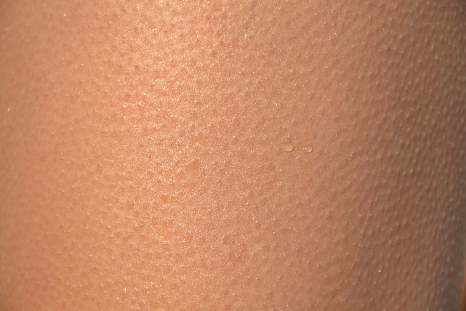 Por qué se nos eriza la piel al escuchar música o sentir miedo: la ciencia detrás de la “piel de gallina”