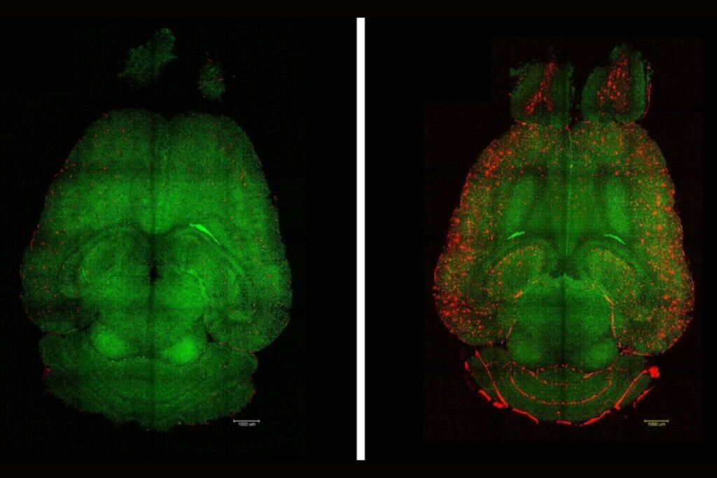 Nanopartículas contra el olvido: científicos logran revertir el Alzheimer en ratones restaurando el cerebro desde sus vasos