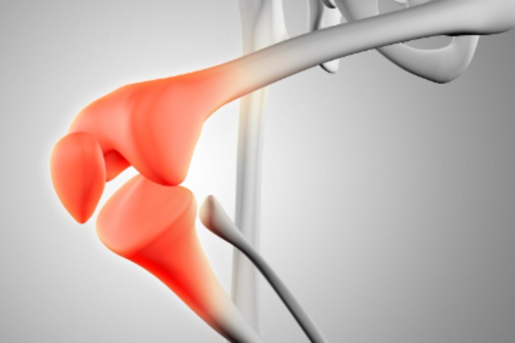 Huesos de acero: qué tienen en común quienes nunca se rompen nada