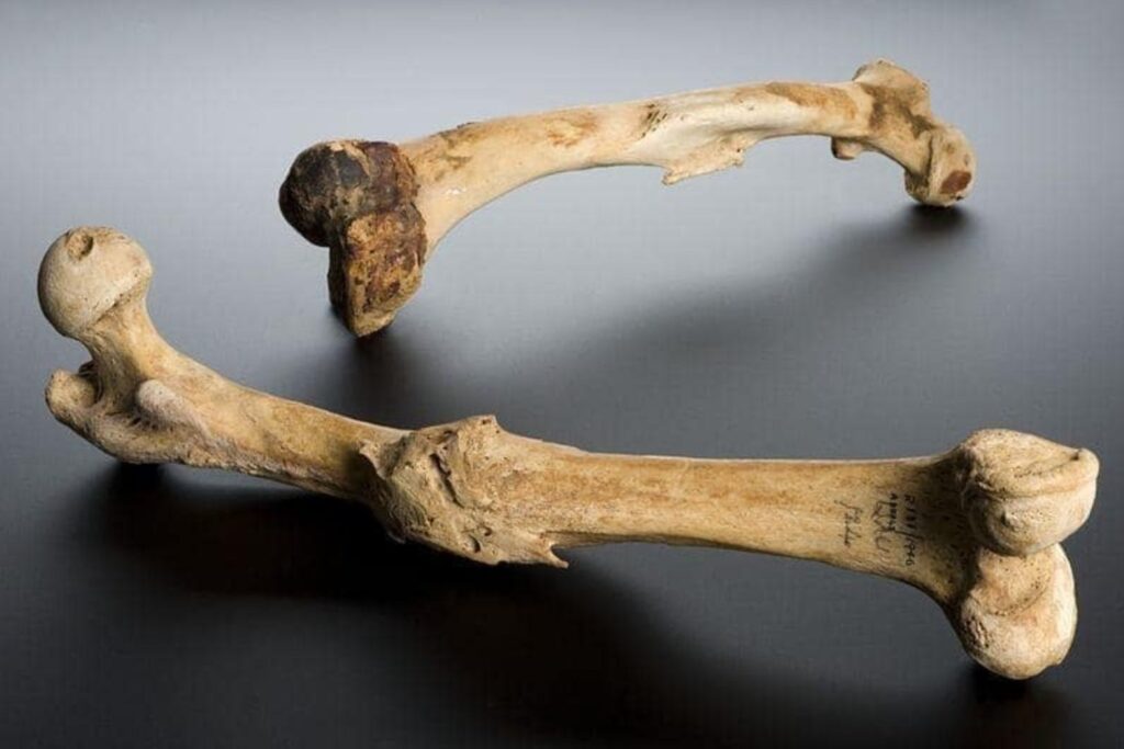 La fragilidad ósea es parte de nuestra evolución, no un efecto del sofá