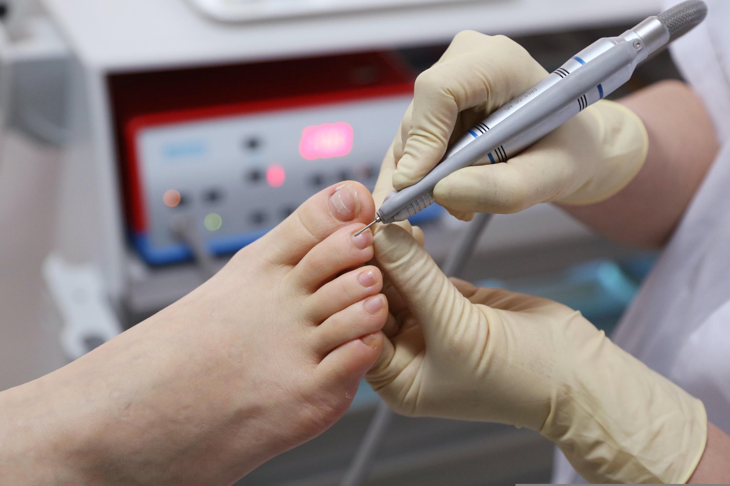 Las uñas de los pies podrían convertirse en la nueva herramienta para detectar la exposición a un gas invisible y cancerígeno