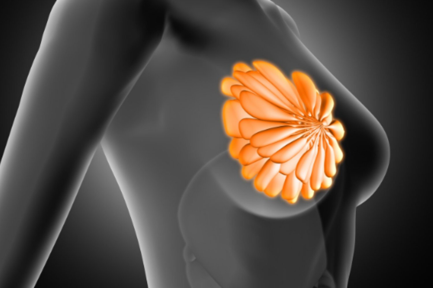 Reconstrucción mamaria: mitos, verdades y avances tras el cáncer de mama
