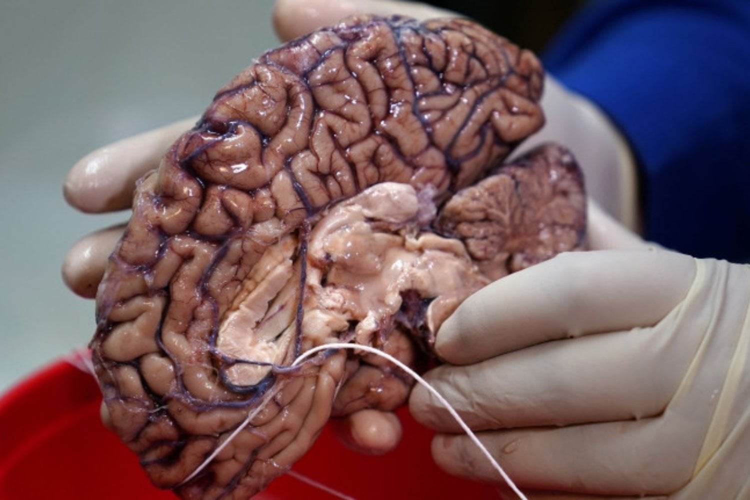 El cerebro no se apaga al morir: sigue cambiando, y la ciencia acaba de descubrirlo