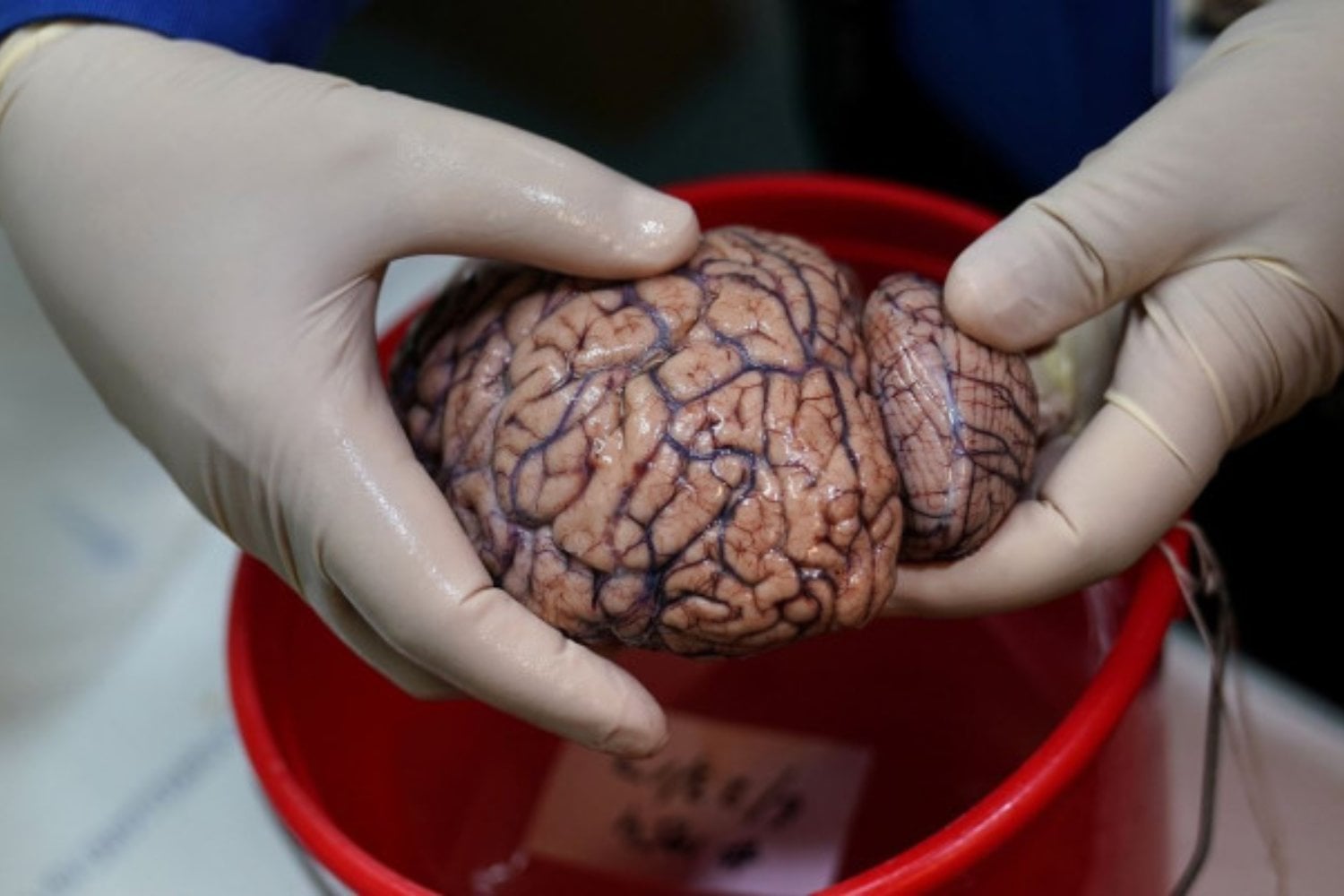 El cerebro no se apaga al morir: sigue cambiando, y la ciencia acaba de descubrirlo