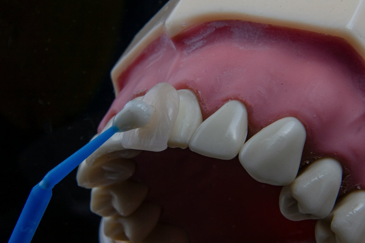 Biomimetica En Dientes Humanos