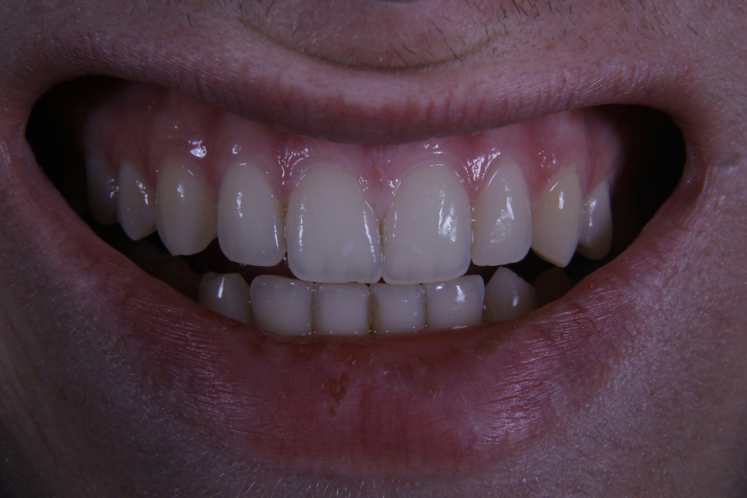 Cultivar Dientes En Laboratorio
