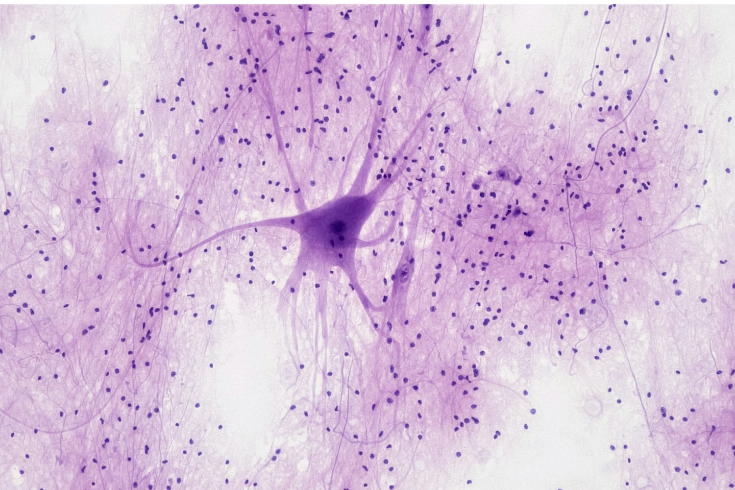 Neuronas Artificiales