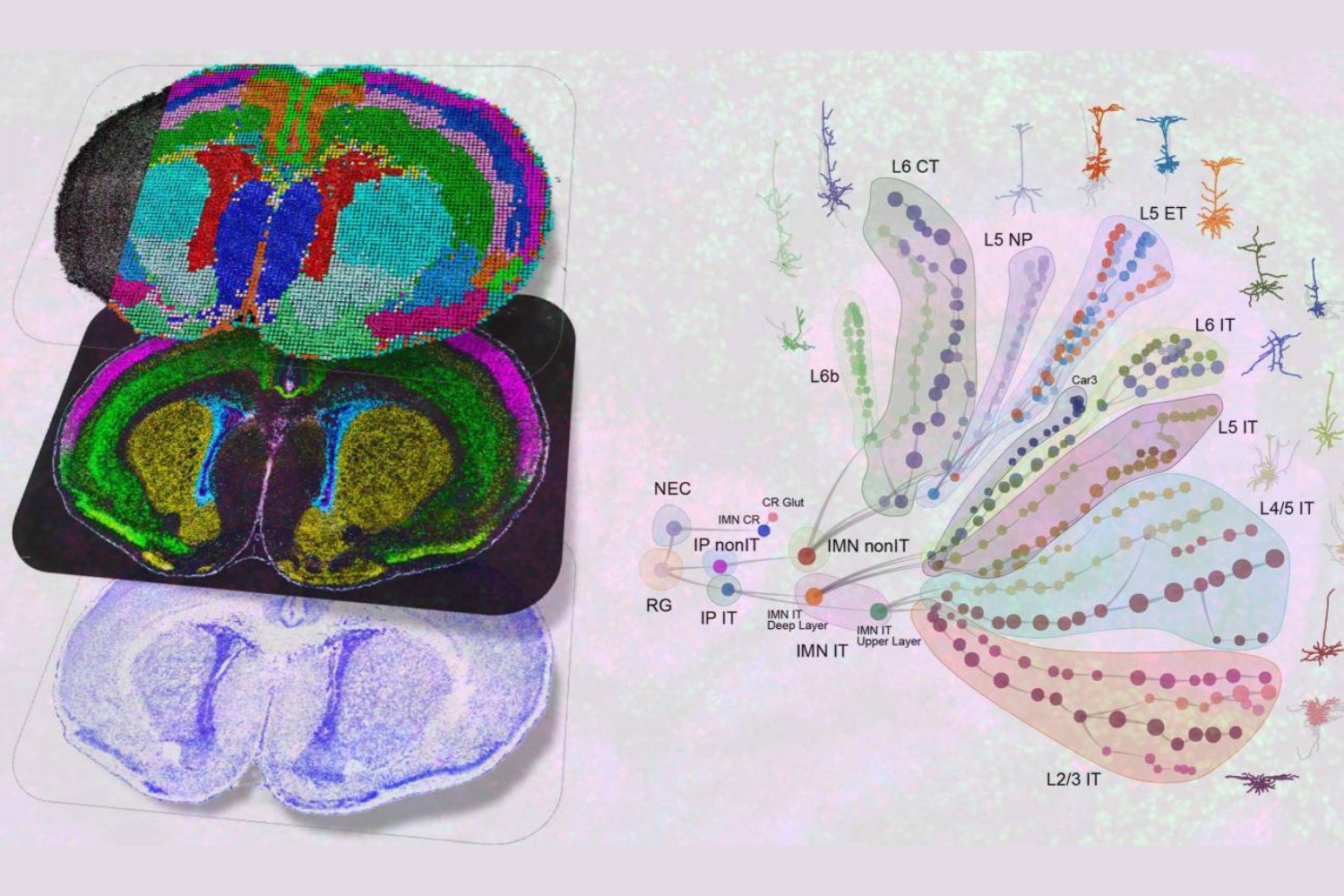El mayor mapa del cerebro humano en desarrollo acaba de completarse. Y lo que revela podría explicar el origen del autismo y la esquizofrenia
