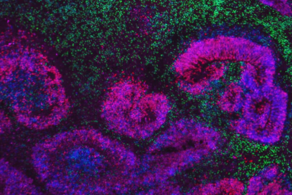 El mayor mapa del cerebro humano en desarrollo acaba de completarse. Y lo que revela podría explicar el origen del autismo y la esquizofrenia