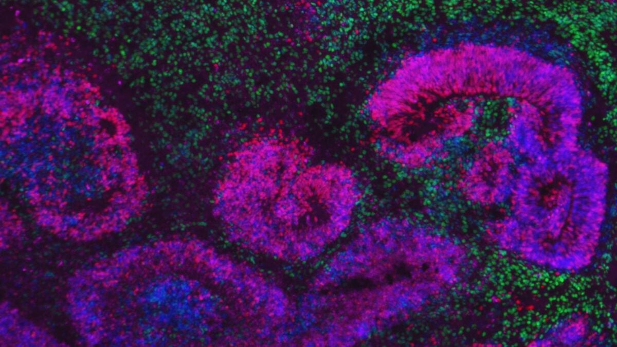 El cerebro humano no está terminado al nacer: sigue reescribiéndose durante años. El mayor atlas celular de su desarrollo revela por qué esa plasticidad nos hace tan inteligentes y tan vulnerables