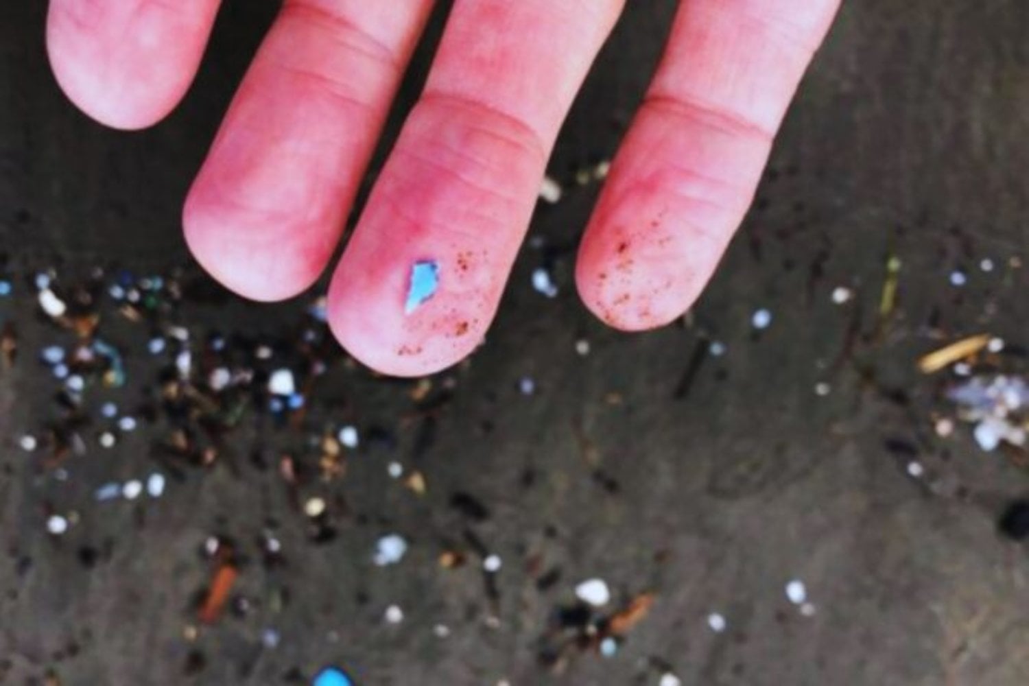 La contaminación era solo el principio. Los microplásticos pueden distribuir bacterias resistentes a antibióticos por ríos, costas y ecosistemas marinos