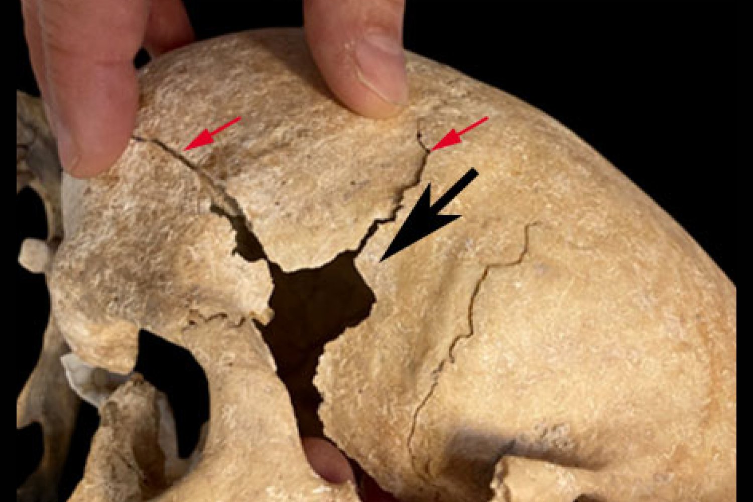 El guerrero que no debía existir: un cráneo anómalo del siglo XIII desconcierta a los científicos y reescribe lo que creíamos sobre la Edad Media