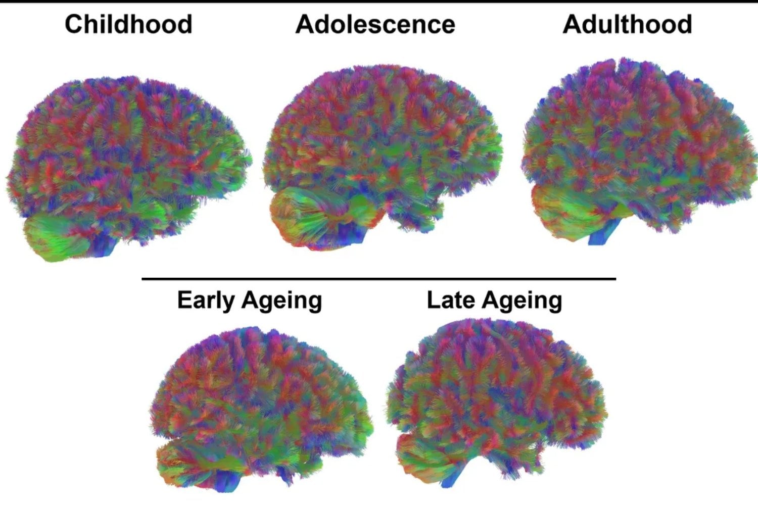 Nuestra vida mental está dividida en cinco actos. A los 9, 32, 66 y 83 años, el cerebro cambia de guion y reorganiza sus conexiones como si empezara otra obra