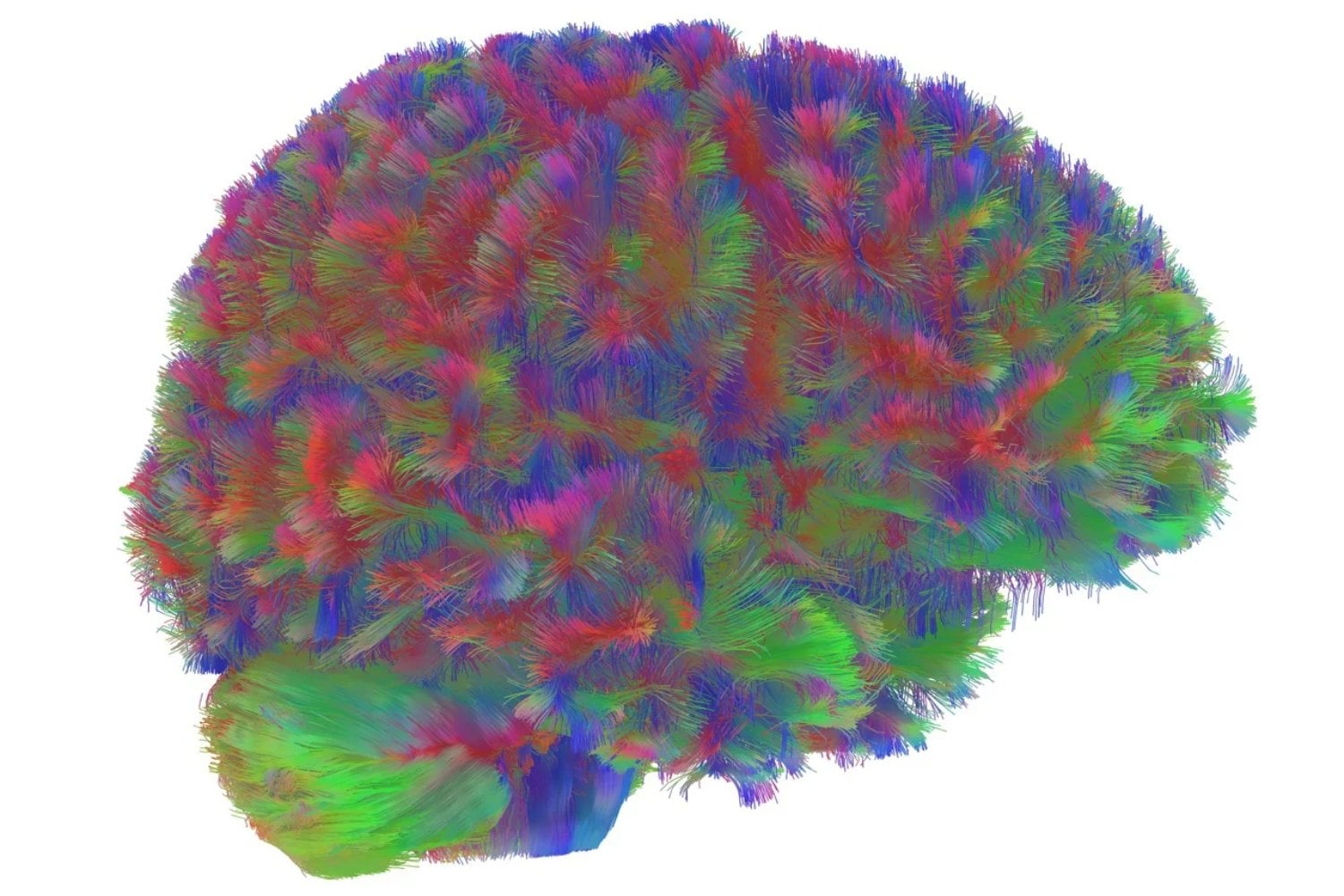 Nuestra vida mental está dividida en cinco actos. A los 9, 32, 66 y 83 años, el cerebro cambia de guion y reorganiza sus conexiones como si empezara otra obra