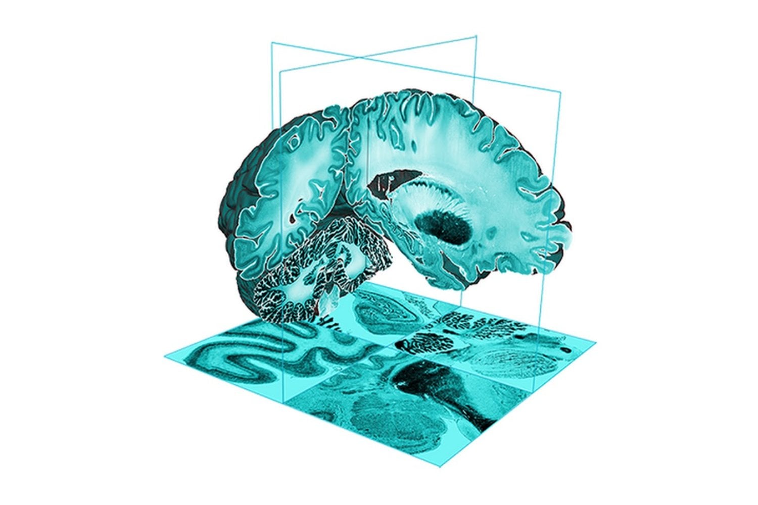 La ciencia logra mapear el cerebro humano desde el útero hasta la madurez: así se forma la mente paso a paso