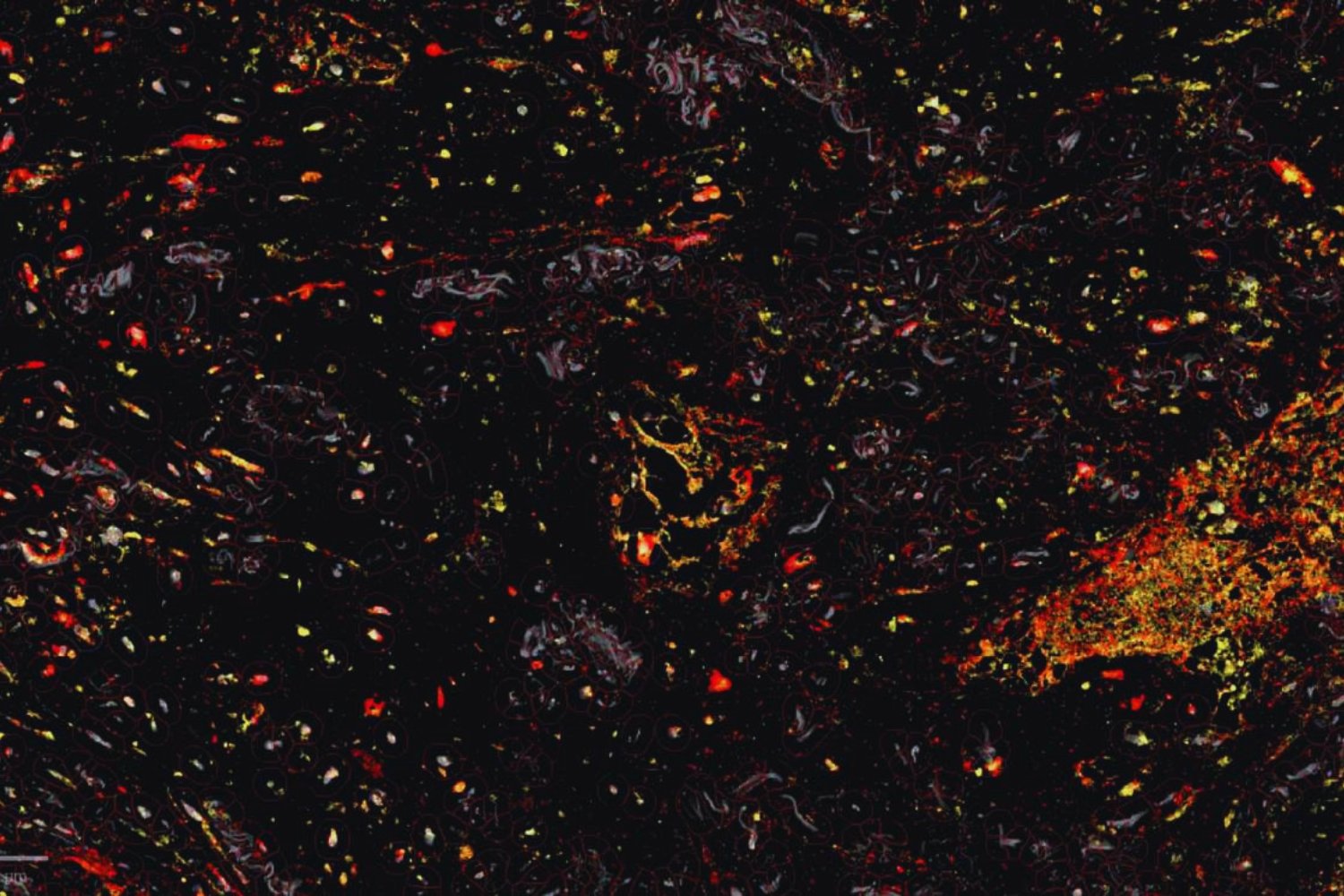 Diseñan moléculas inteligentes capaces de reprogramar la defensa de los tumores desde dentro. El hallazgo apunta a una nueva era de inmunoterapia más precisa y localizada