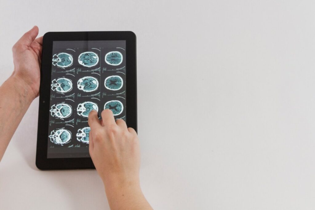 El cerebro aprende reorganizándose: descubren el orden oculto detrás de cómo pensamos y decidimosEl cerebro aprende reorganizándose: descubren el orden oculto detrás de cómo pensamos y decidimos