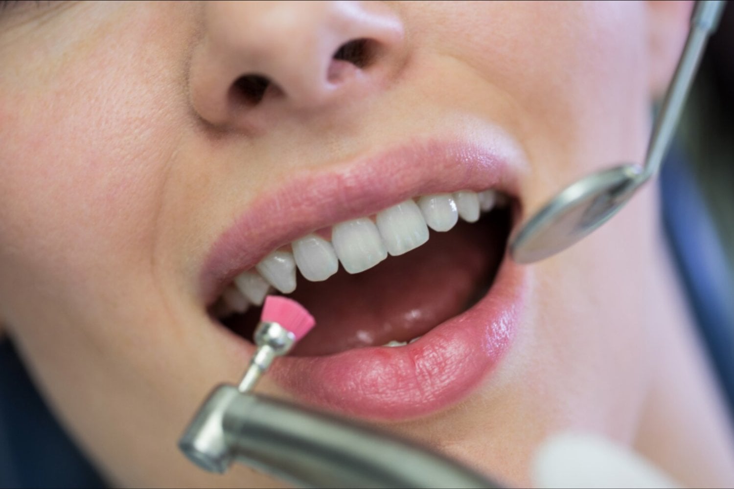 Regenerar el esmalte dental ya no es un sueño: científicos logran reconstruirlo usando queratina de lana de oveja