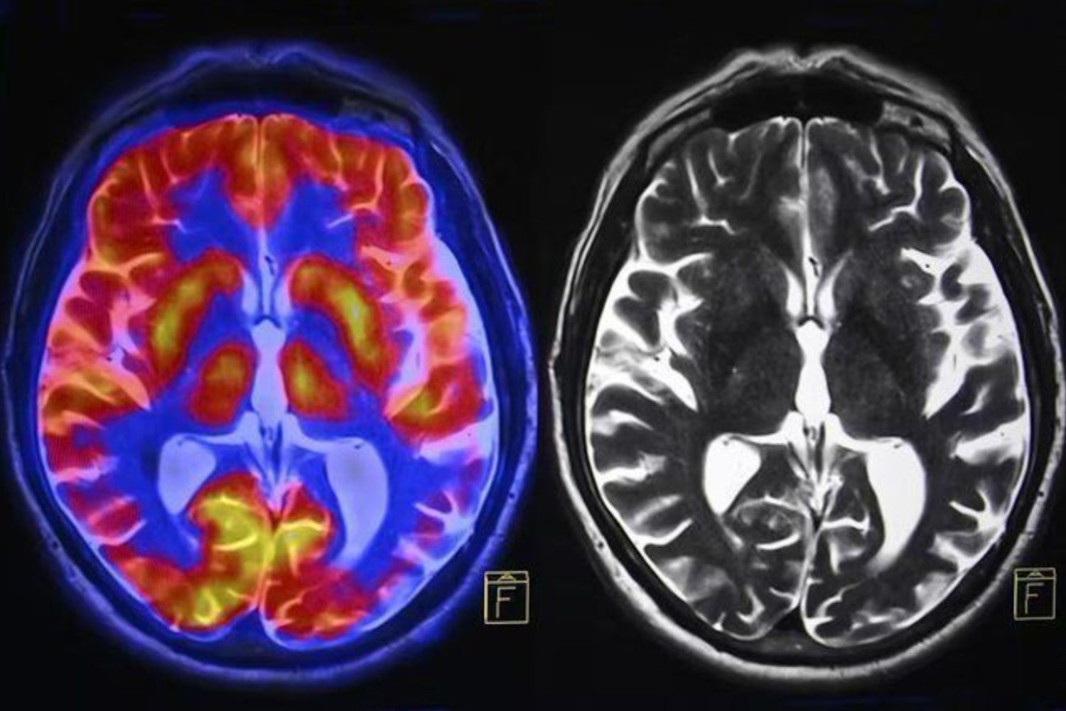 Tu cerebro sabotea tus cambios sin que lo notes: así funcionan las tres trampas ocultas que te frenan