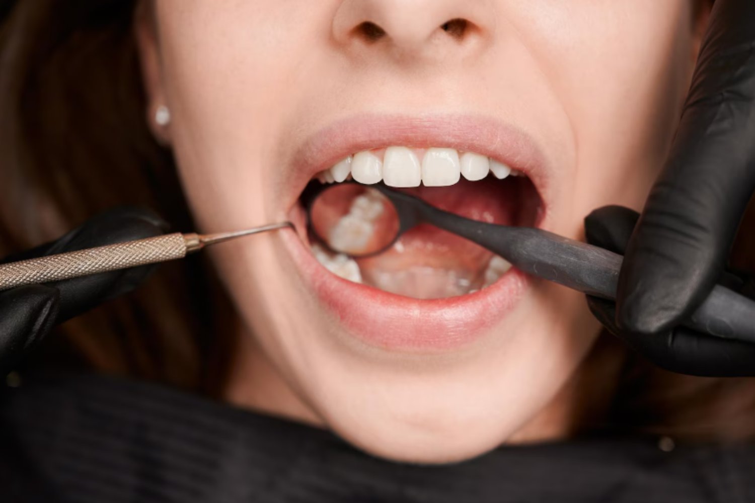 “Por la noche es cuando más daño haces a tus dientes”: la ortodoncista Almudena Herraiz explica por qué ese cepillado es el más importante