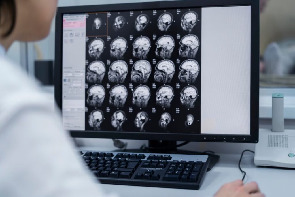 El desafío silencioso de la neurología: por qué el cerebro se ha convertido en la gran frontera médica del siglo XXI