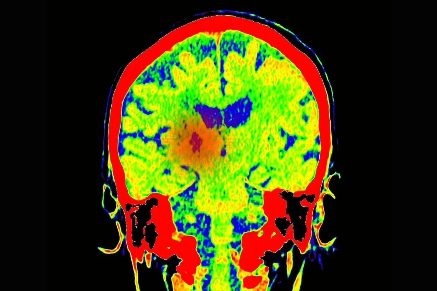 Por qué el cerebro aprende tan rápido lo que le hace daño. El interruptor oculto que acelera la formación de hábitos