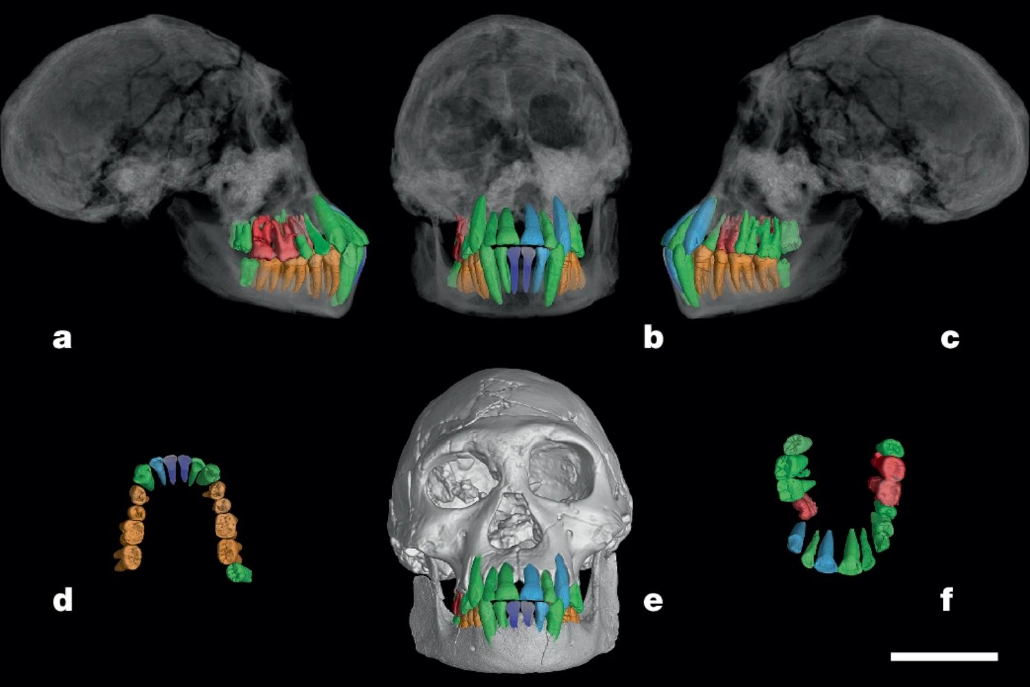 Antes de fábricas y tuberías ya había plomo. La evidencia fósil que reescribe el entorno en el que evolucionó el cerebro humano