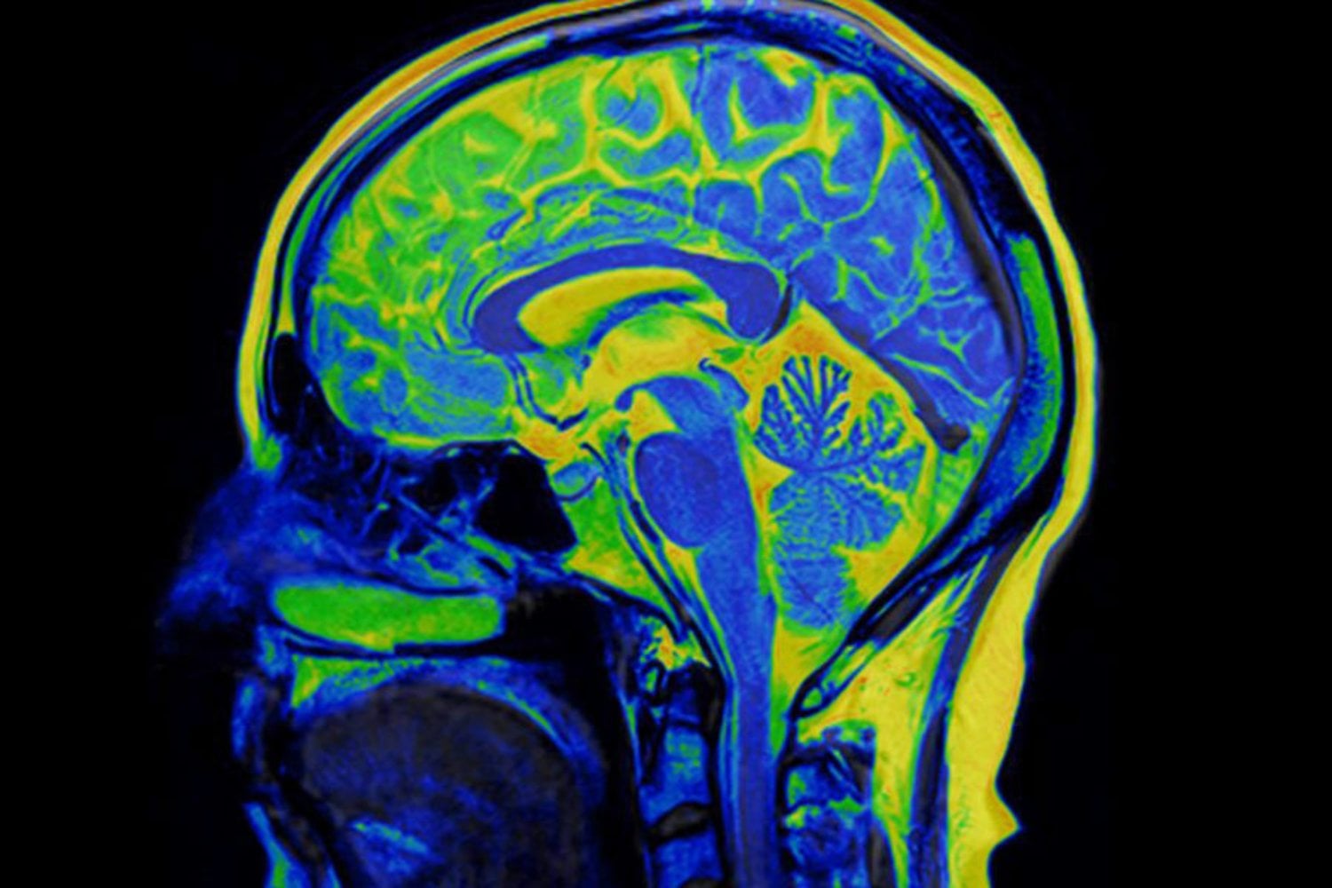 Por qué el cerebro aprende tan rápido lo que le hace daño. El interruptor oculto que acelera la formación de hábitos