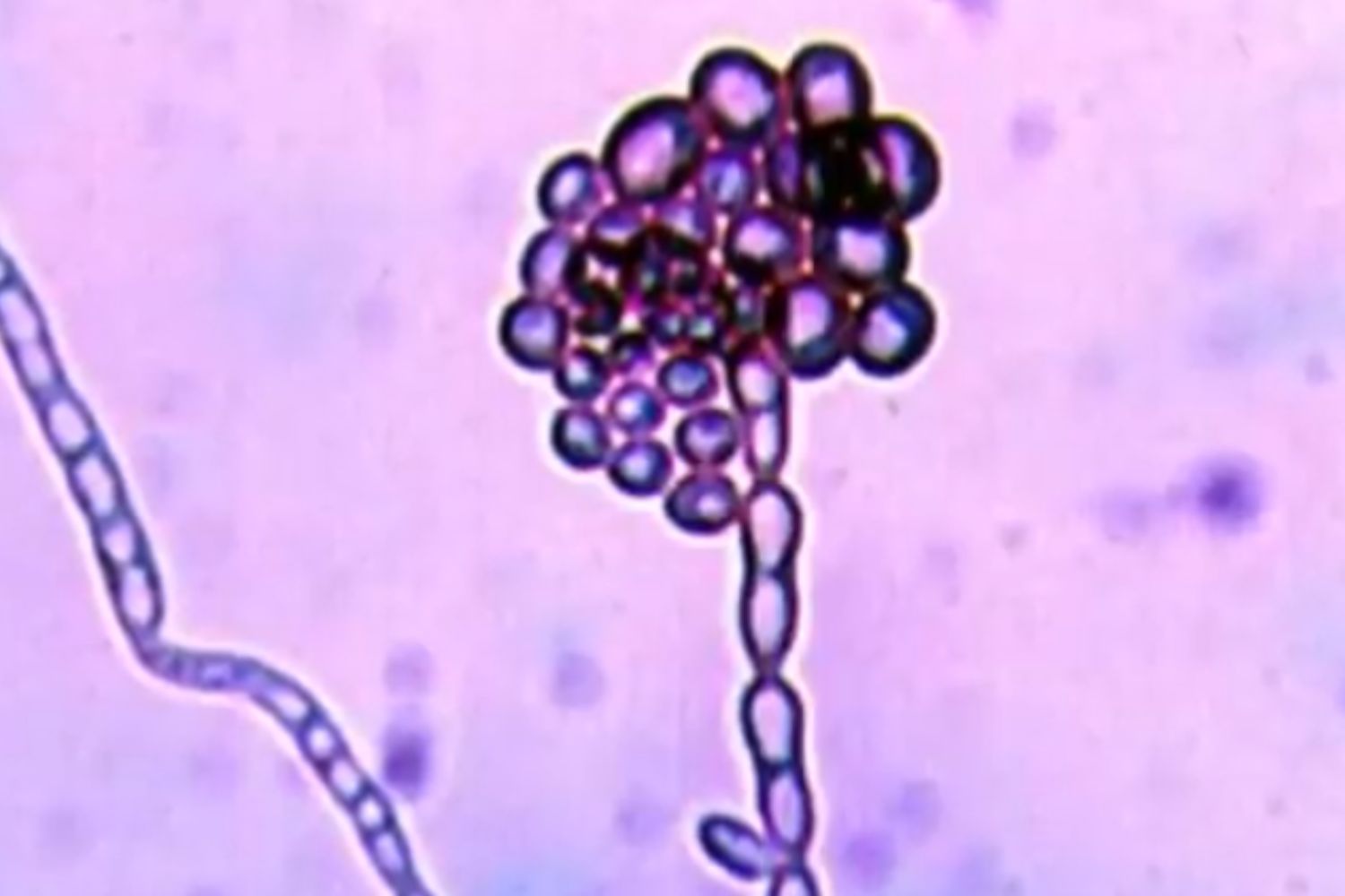 La criatura microscópica que desafía las leyes en la zona más tóxica del  planeta
