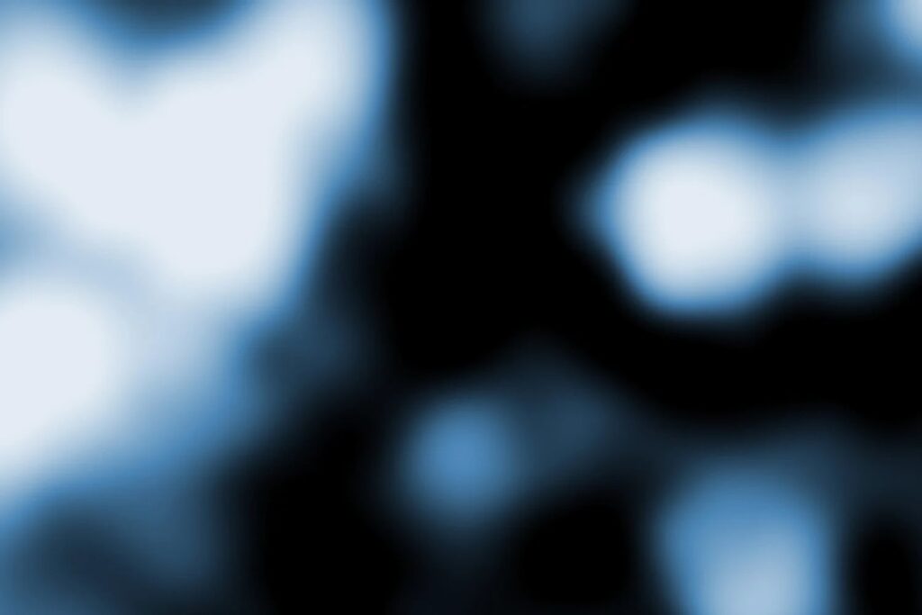 Por fin sabemos de dónde vino la ráfaga de radio más potente jamás detectada. Y por qué este hallazgo cambia el estudio del universo extremo