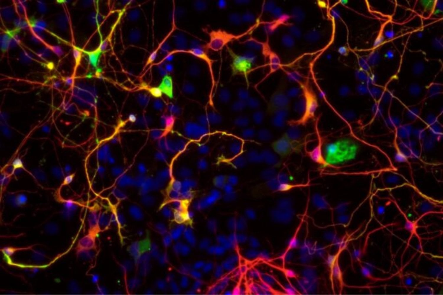 Creíamos que el Parkinson estaba escrito en nuestros genes. Ahora la ciencia empieza a mirar al agua, al aire y a los químicos cotidianos