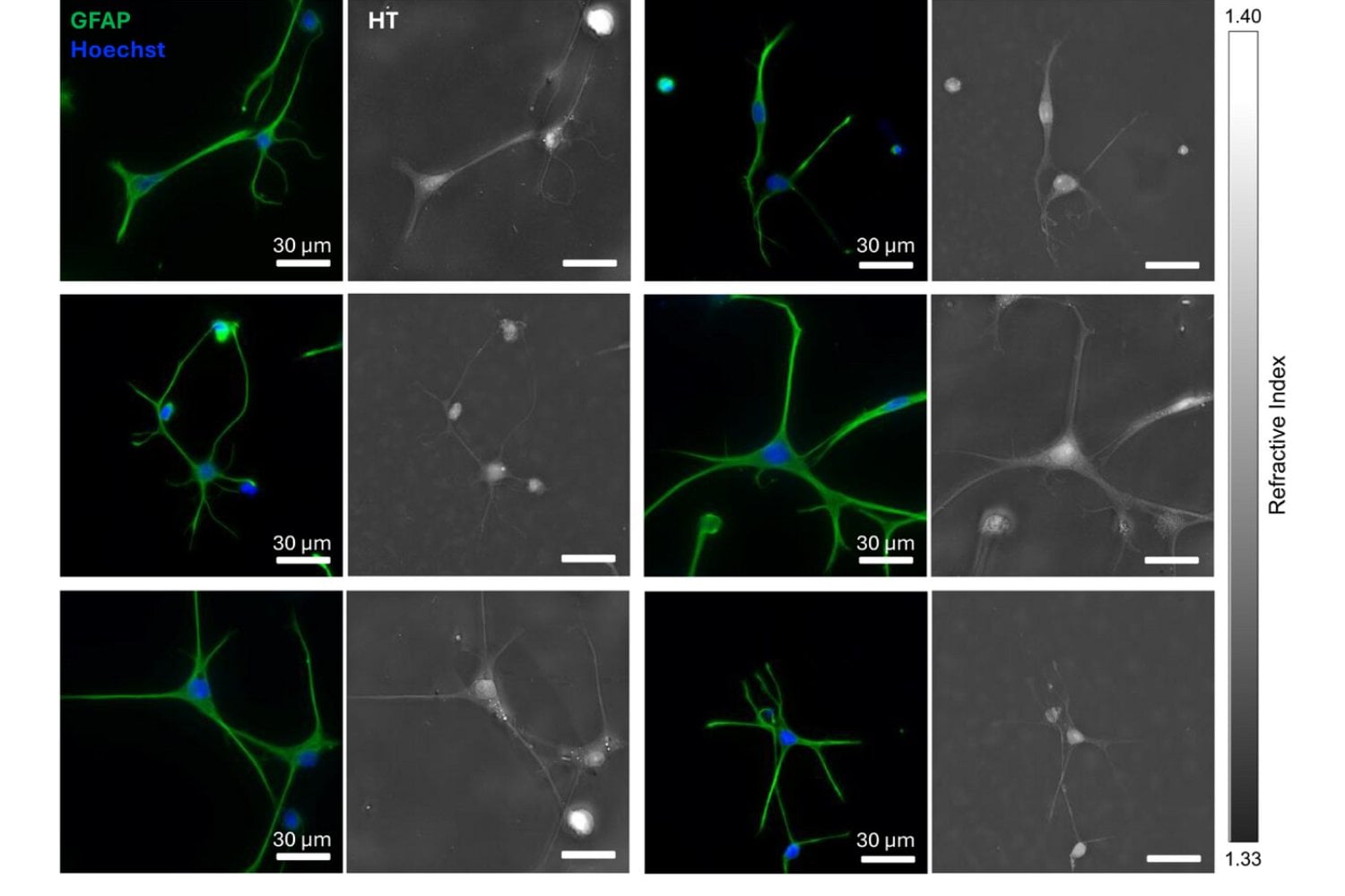 Las células olvidadas del cerebro estaban engañándonos. Un experimento permitió ver a los astrocitos en su forma real por primera vez y podría cambiar la investigación neurológica