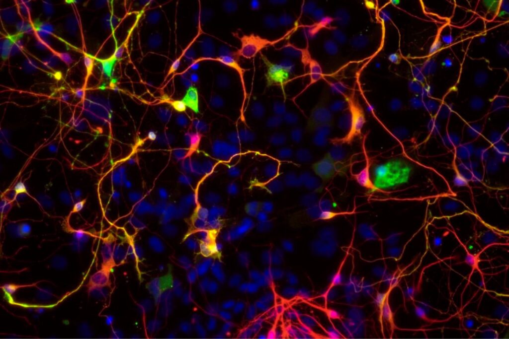 Las células olvidadas del cerebro estaban engañándonos. Un experimento permitió ver a los astrocitos en su forma real por primera vez y podría cambiar la investigación neurológica
